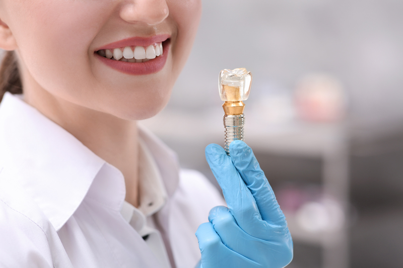 How to Efficiently Search for Affordable Teeth Implants